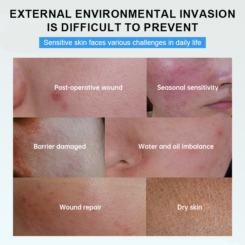 Sterile Grade Medical Skin Care Abrasions Laceration Skin Repair Dressing