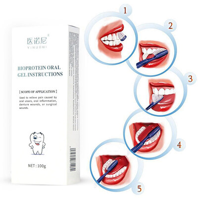 علاج سريع للقرحة الفمية جيل مريح تخفيف الألم من الجروح الفموية